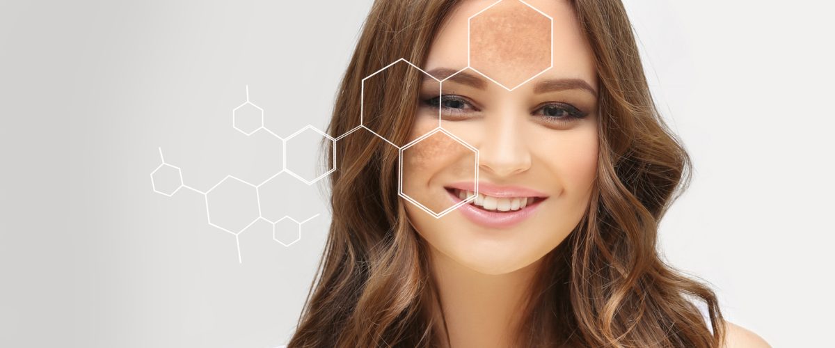 dark spots, freckles,hyperpigmentation(melasma or chloasma),concept skin lightening, skin whitening, fruit acids,aha, skin brightening